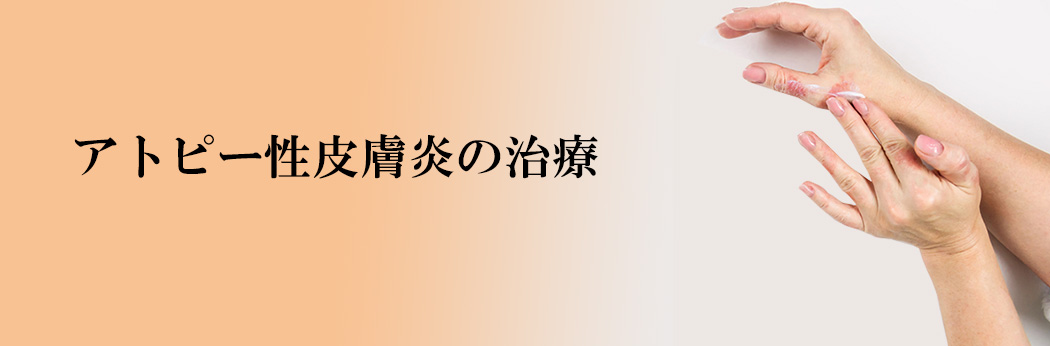 アトピー性皮膚炎の治療
